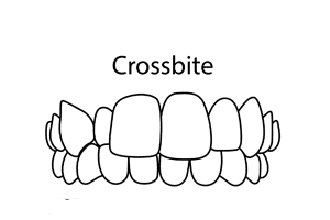 HD-Ortho-Why-Choose-an-Invisalign-Diamond-Plus-Provider