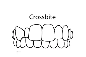 HD-Ortho-Why-Choose-an-Invisalign-Diamond-Plus-Provider