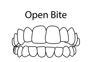 HD-Ortho-best-invisalign-bonney-lake-wa