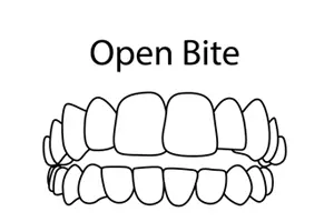 HD-Ortho-best-invisalign-bonney-lake-wa