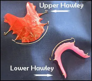 types of retainers