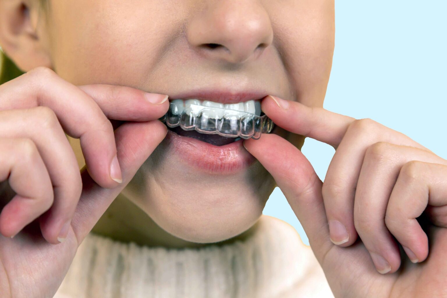 How Much Does Invisalign Cost? HiltonDiminick Orthodontics