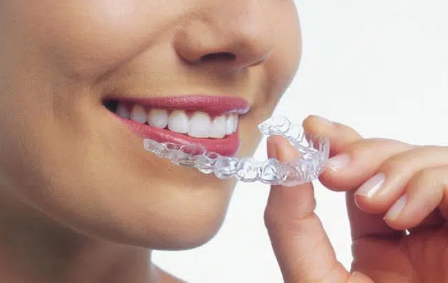 How Much Does Invisalign Cost?