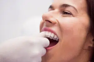 Invisalign in Cumberland Valley