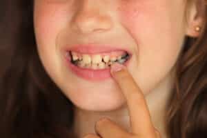 pediatric orthodontist Harrisburg PA