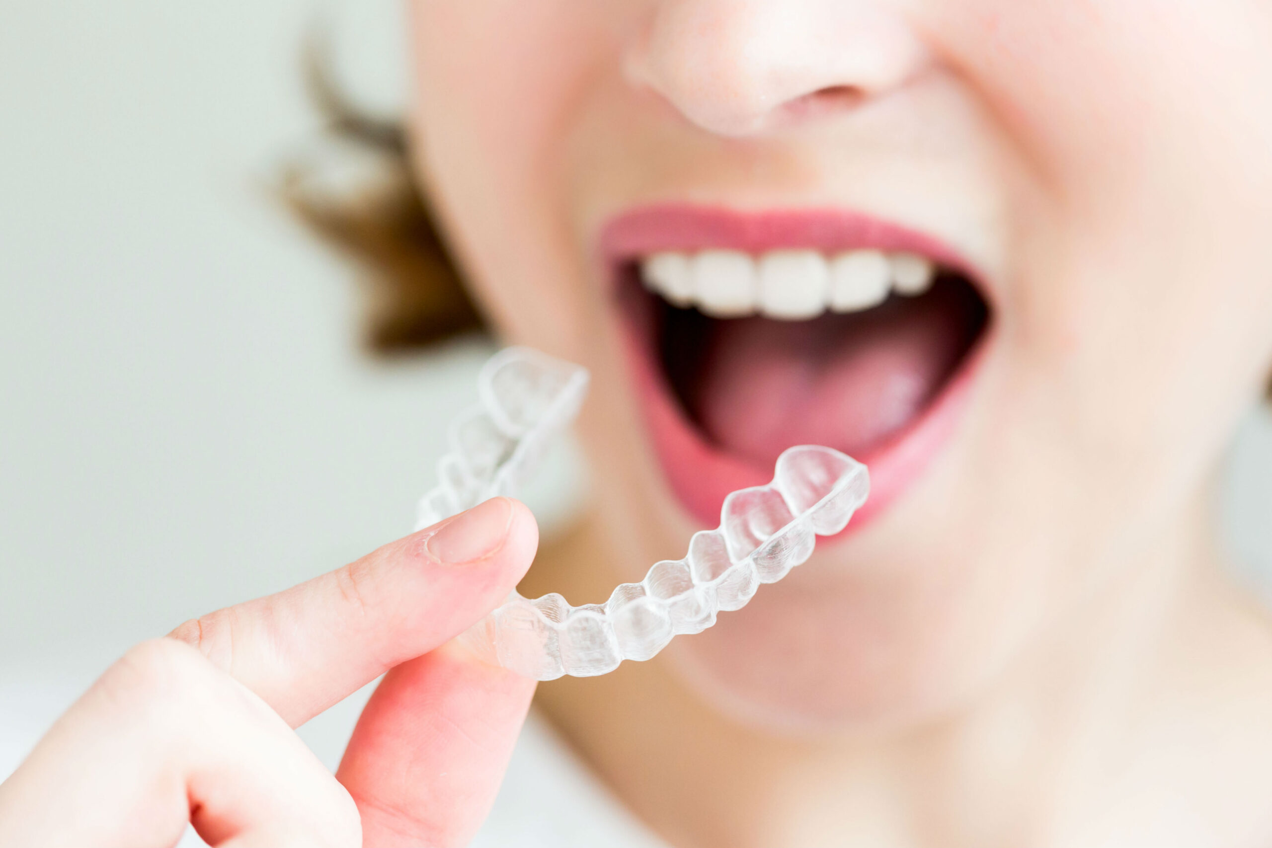 Can You Eat With Invisalign?