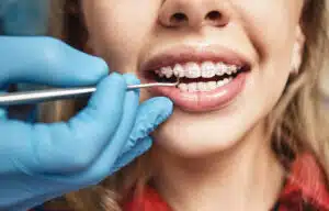 Teens and Braces