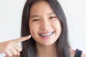 Braces vs. Invisalign for Kids