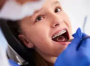 Braces vs. Invisalign for Kids