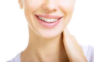 How Long Do You Have To Wear A Retainer