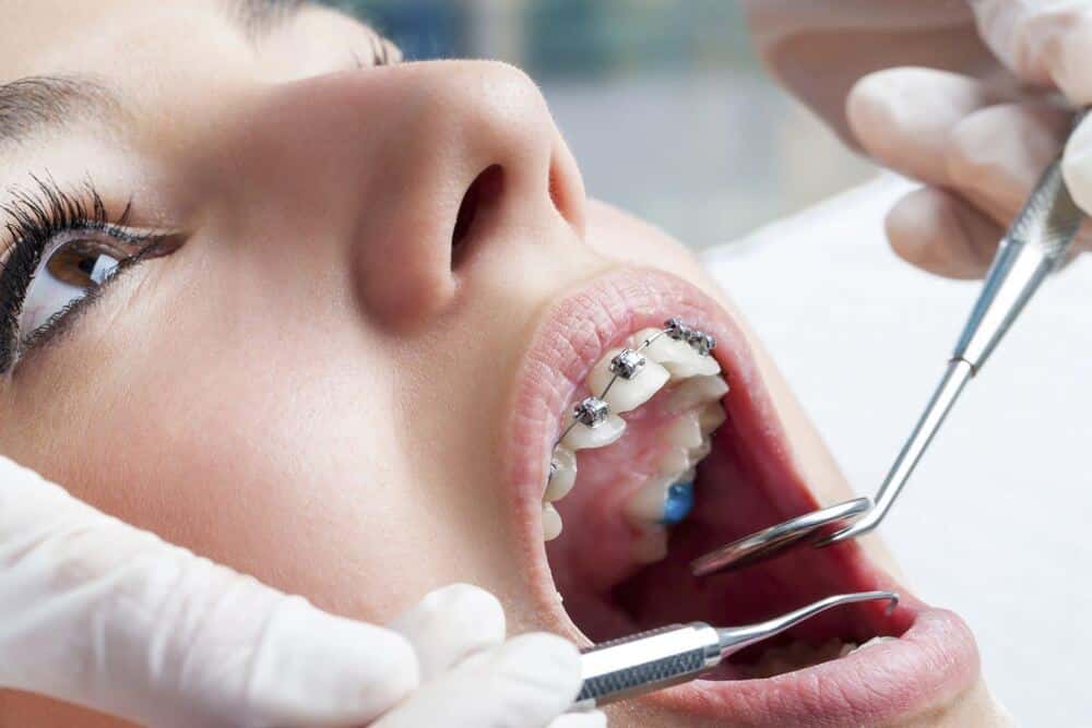 Braces in Carlisle