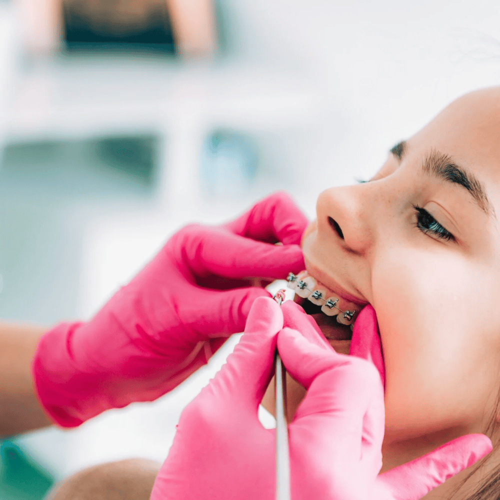 Best orthodontic braces in Carlisle