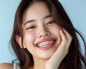 how do dental braces work