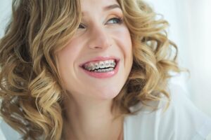 how do braces actually work