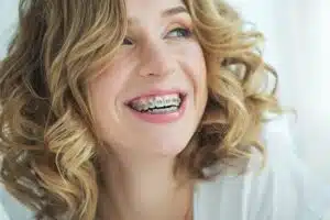 how do braces actually work