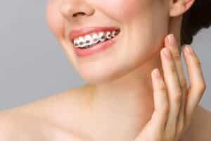 how do braces fix teeth