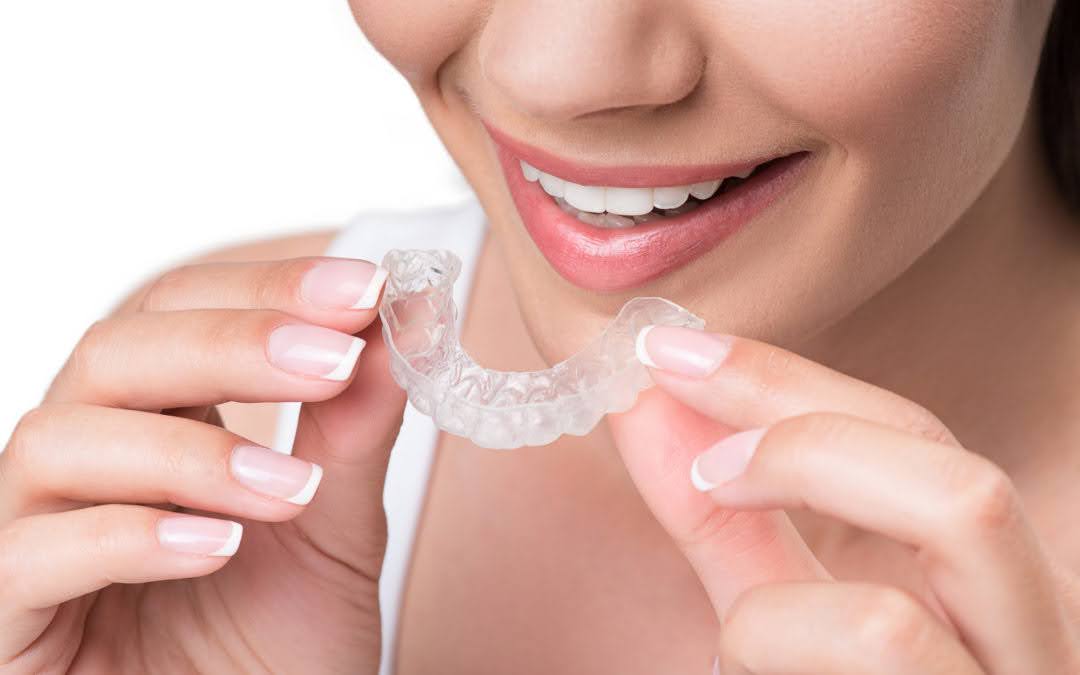 Adult woman using Invisalign teeth aligners for teeth straightening
