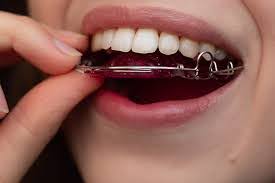 Woman putting in a retainer and showing different retainer types